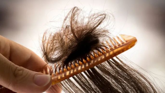¿Nudos en el cabello? Conoce de qué se trata la triconodosis y cómo te afecta 