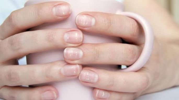 ¿Tienes puntos blancos en las uñas? Descubre cuáles son las posibles causas