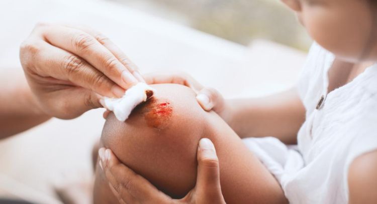 4 productos naturales que alivian heridas leves en la piel; pueden acelerar la cicatrización